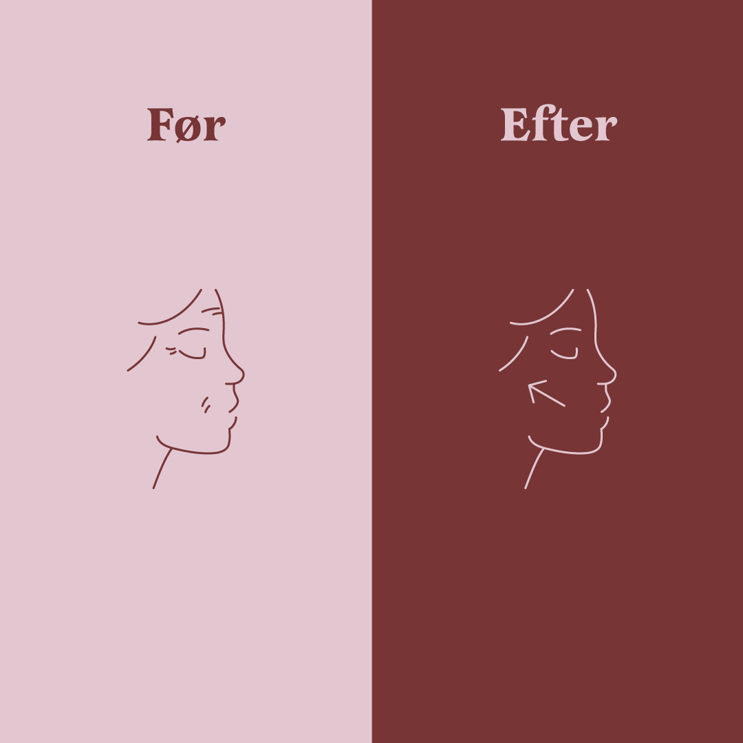 The Skin One