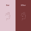The Skin One
